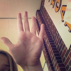 My super rare hand 😂